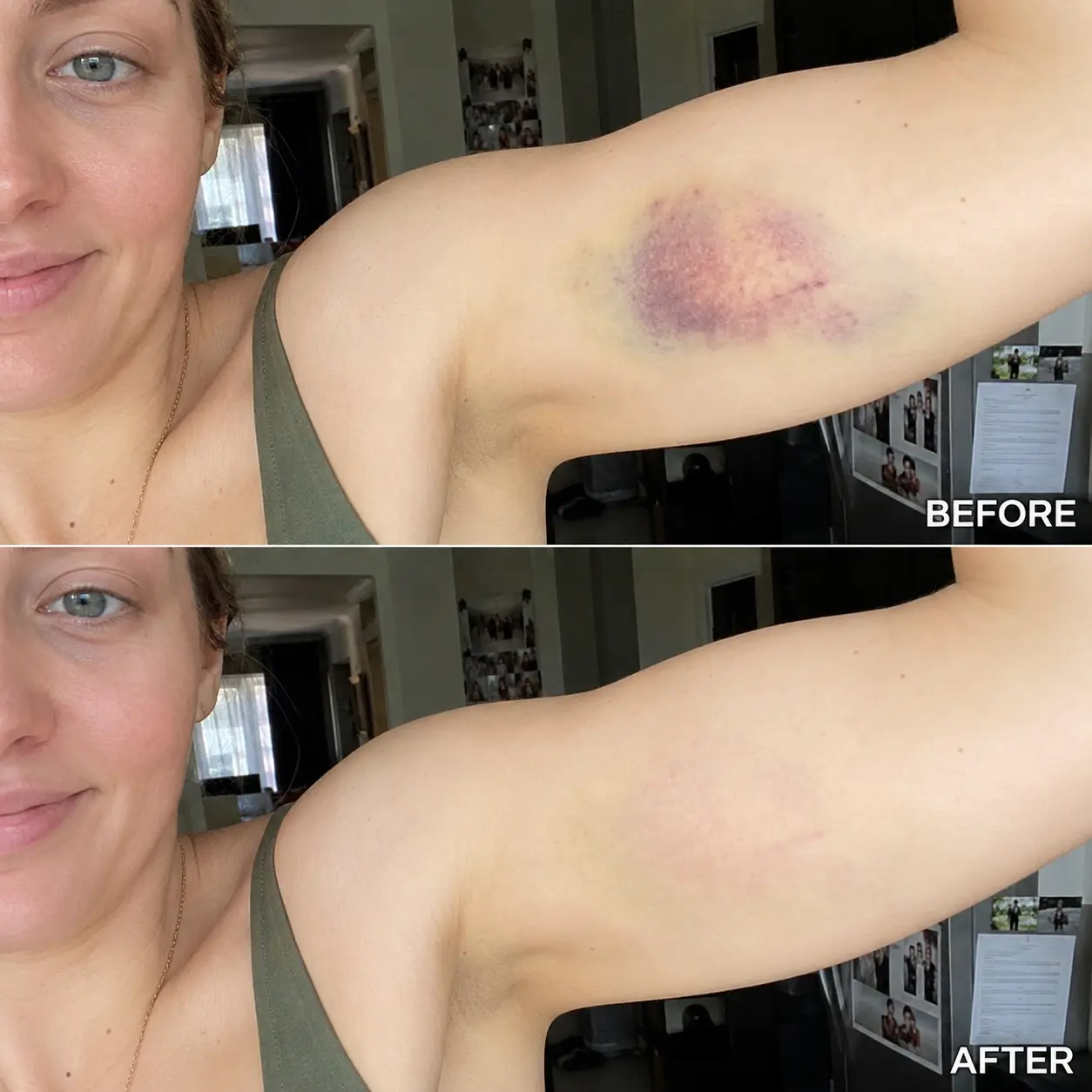 BruiseFade Pro Skin Repair Cream - Image 9