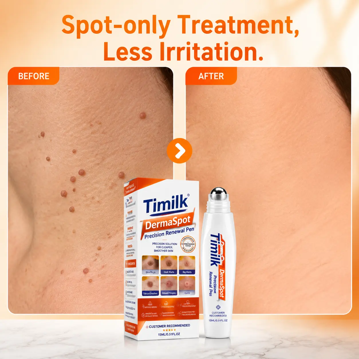 DermaSpot Precision Renewal Pen - Image 7