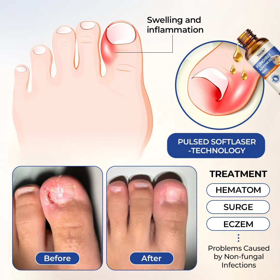 FungiBee Advanced Nail Repair Solution - Image 2