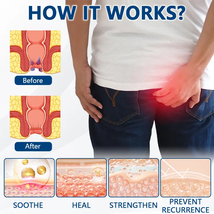 HemoRelief Herbal Spray - Image 5