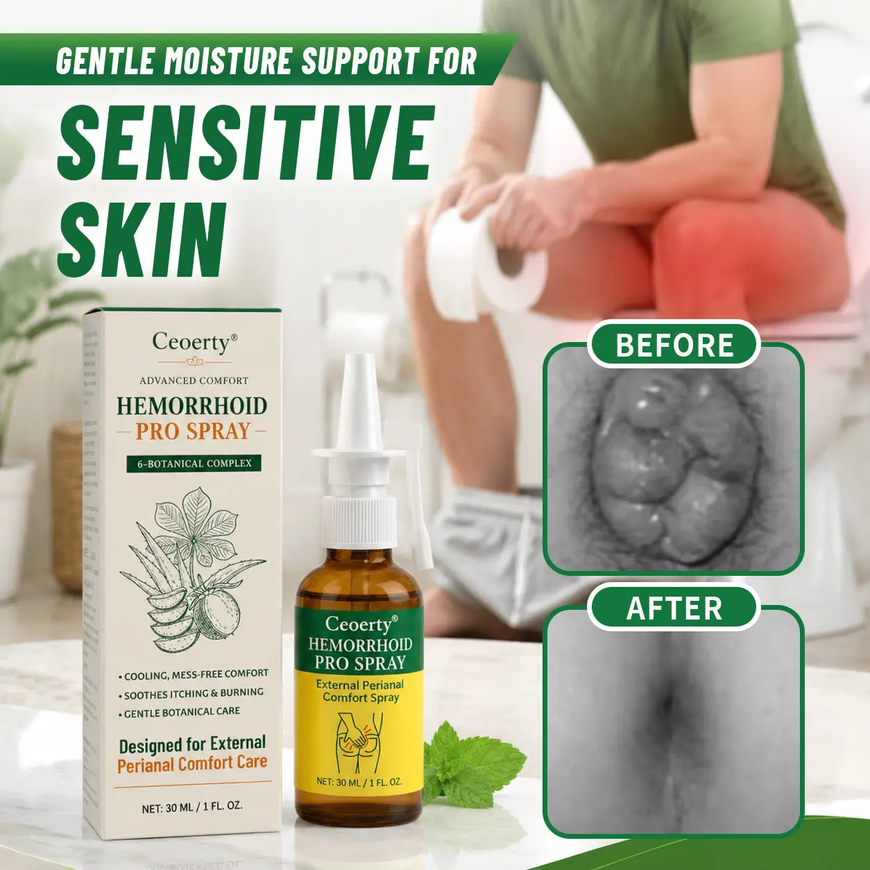 ProctoEase Hemorrhoid Gel - Image 3