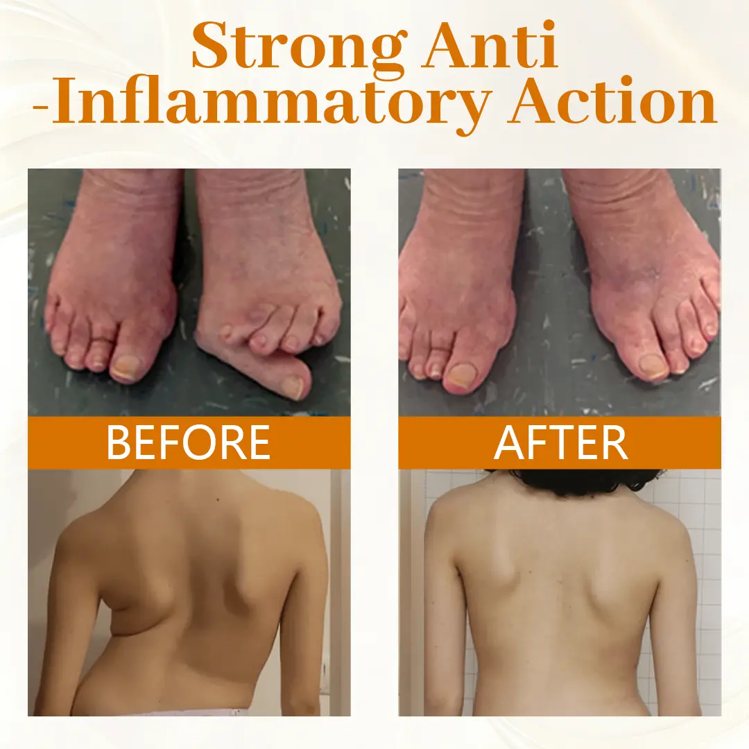 ScorpiTakt Joint & Muscle Relief Ointment - Image 3