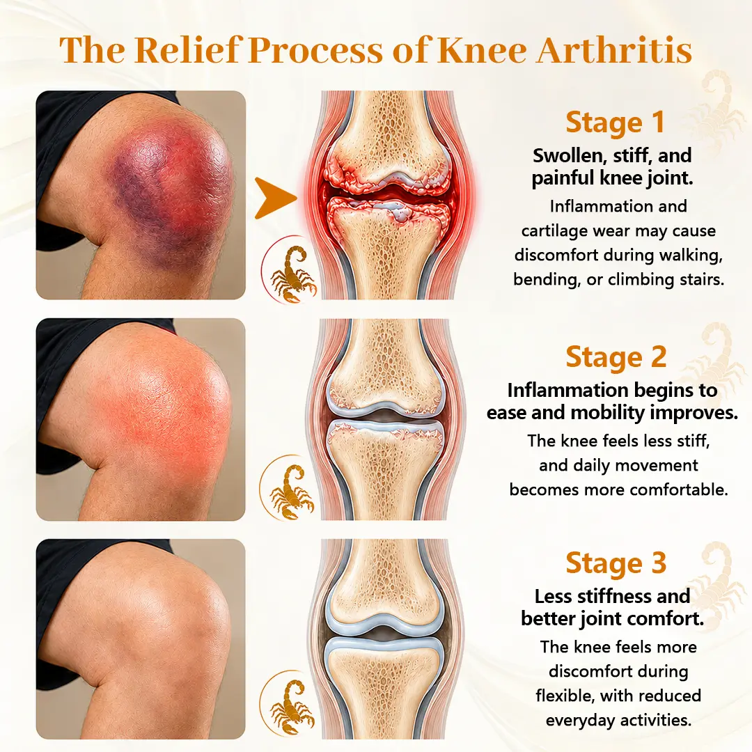 ScorpiTakt Joint & Muscle Relief Ointment - Image 6
