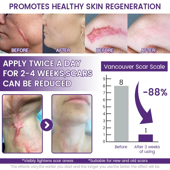 SkinRenew Smoothing Gel - Image 5