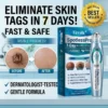 SpotlessPro Advanced Skin Care Pen
