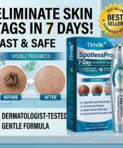 SpotlessPro Advanced Skin Care Pen