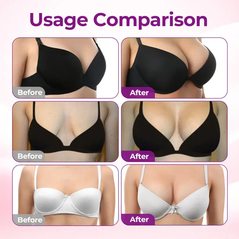 Targeted Breast Enhancement Advanced Nano Patch - Image 3