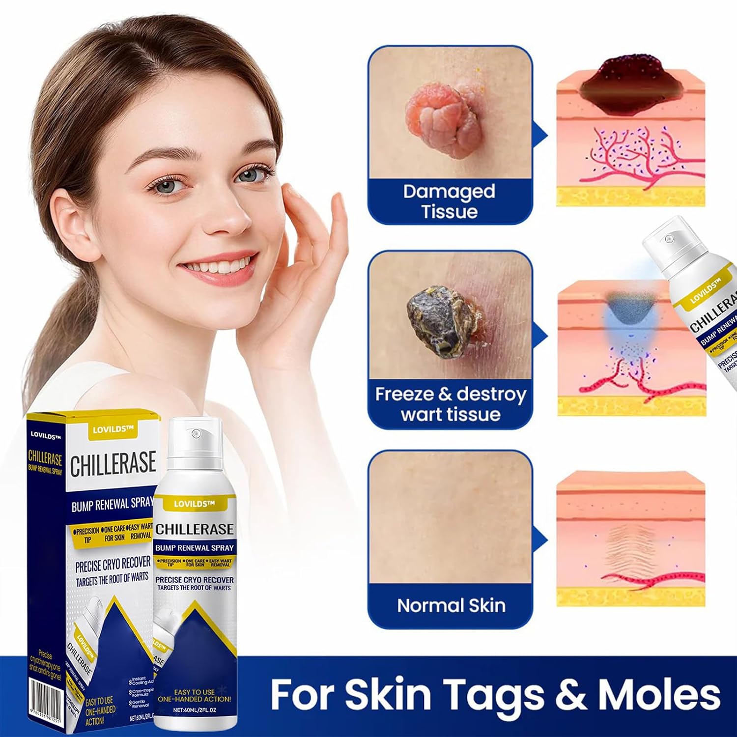Skin Renewal Spray for Skin Bumps - Image 3