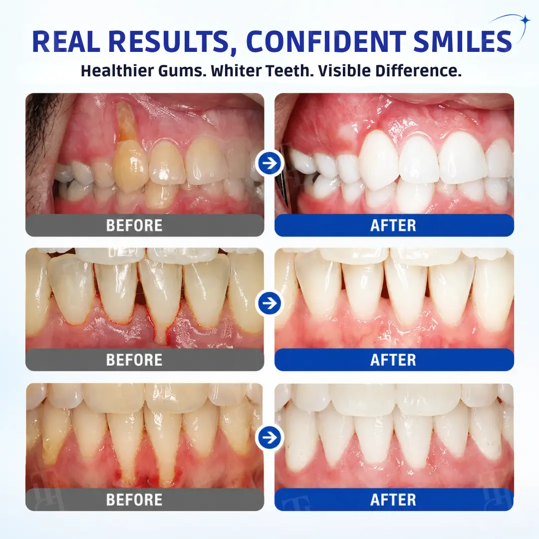 Gum Protect Repair Gel - Image 2