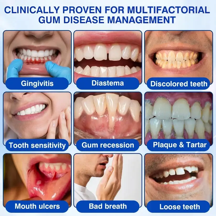 GumRevive Periodontal Repair Gel - Image 9