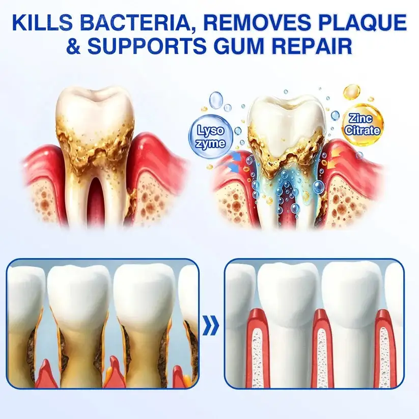 GumRevive Periodontal Repair Gel - Image 11