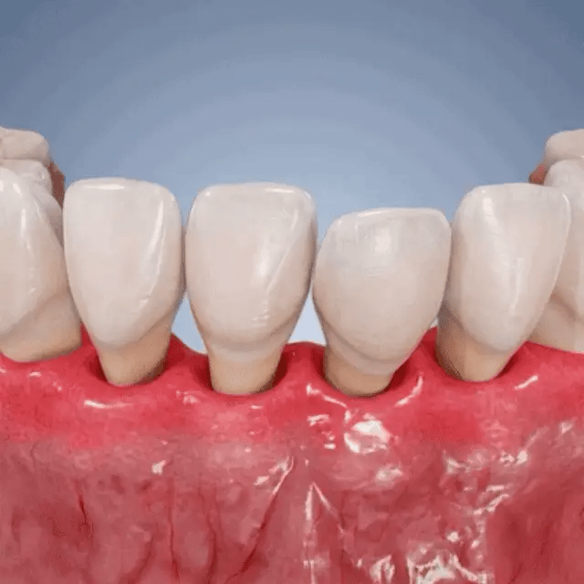 GumRevive Periodontal Repair Gel - Image 19