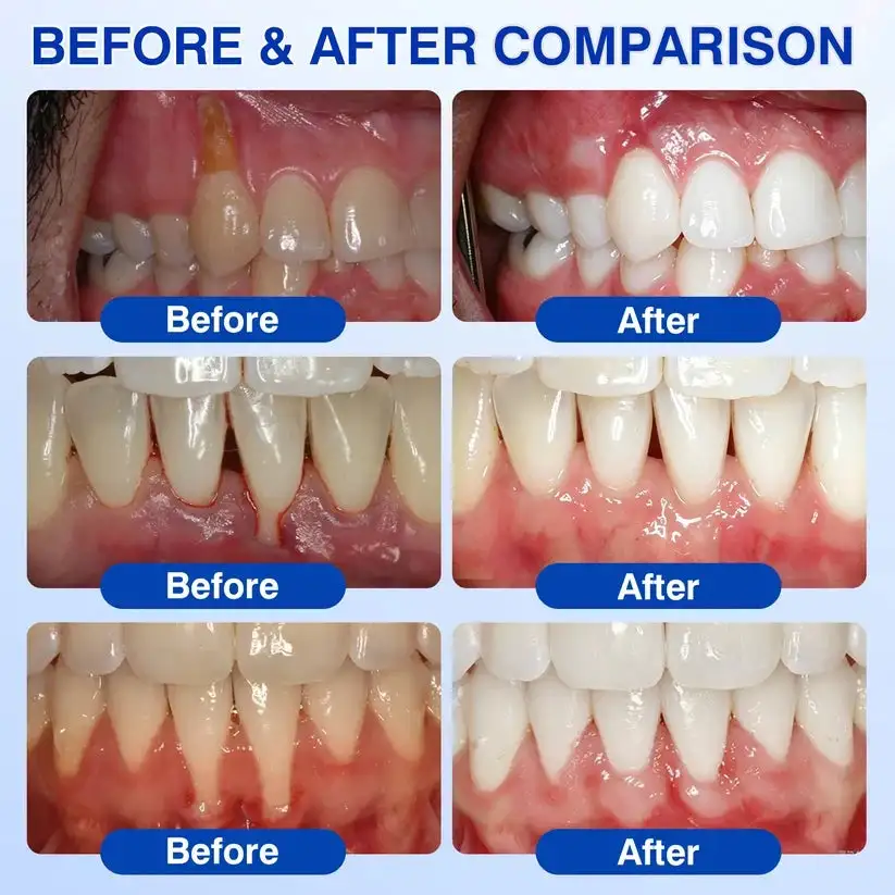 GumRevive Periodontal Repair Gel - Image 5