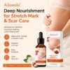SilkStretch Natural Stretch Mark & Scar Oil
