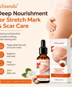 SilkStretch Natural Stretch Mark & Scar Oil