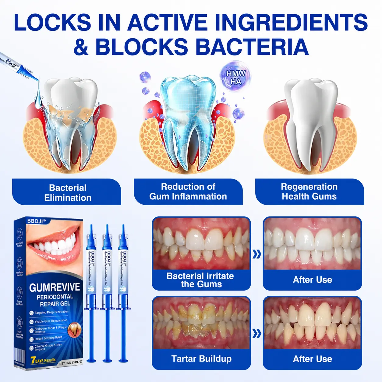 GumRevive Periodontal Repair Gel - Image 8