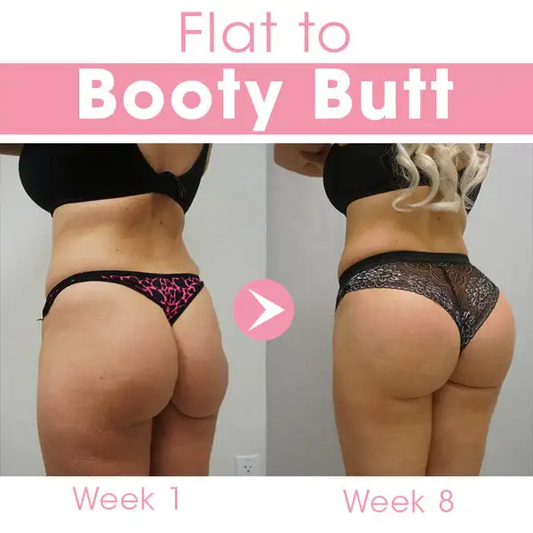 Body Enhancement Cream - Image 5