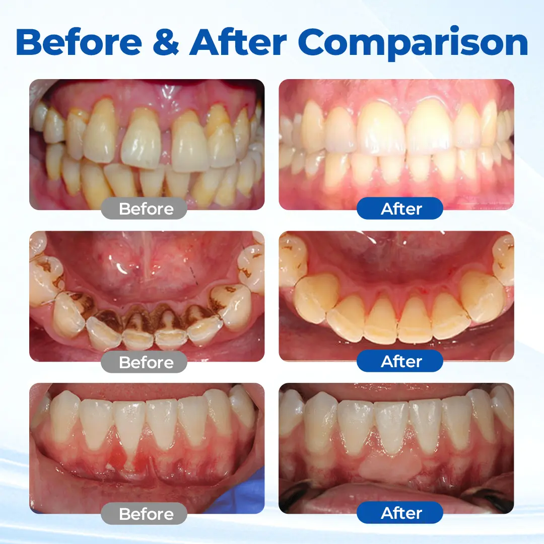 GumBiome Recovery Gel - Image 2