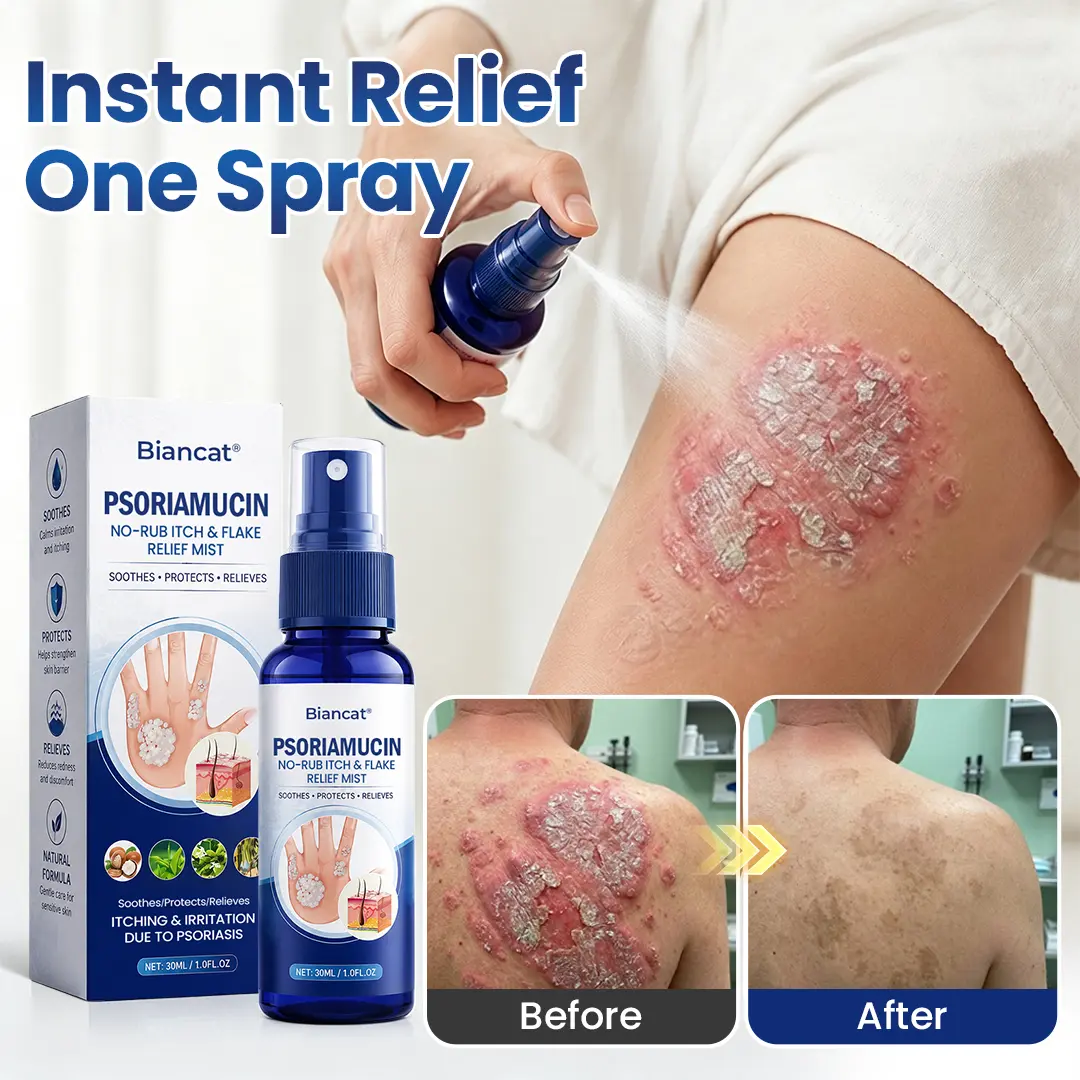PsoriaMucin No-Rub Itch & Flake Relief Mist - Image 2