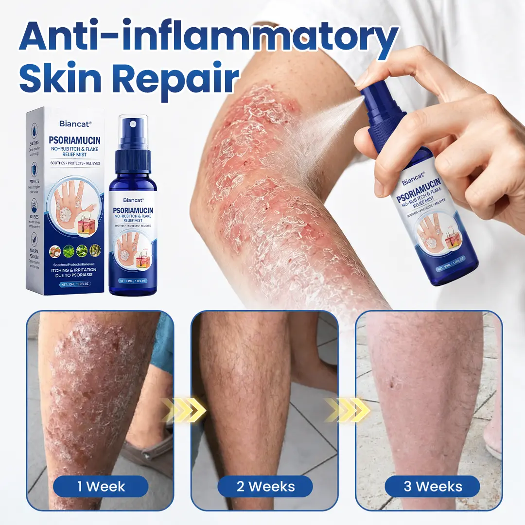 PsoriaMucin No-Rub Itch & Flake Relief Mist - Image 4