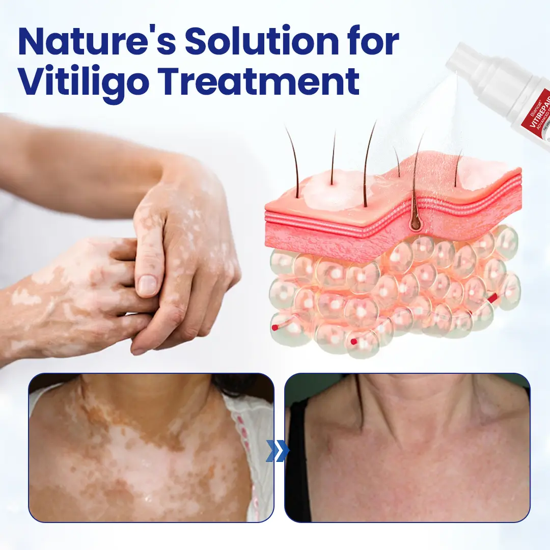 VitiRepair Advanced Spray - Image 4