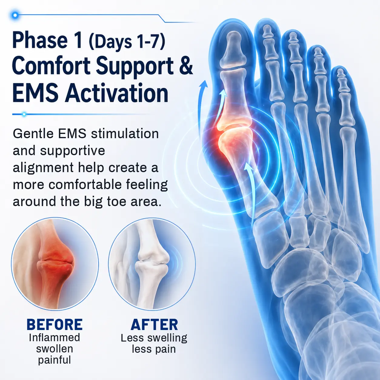 FootAlign EMS Pro —— Advanced EMS Foot Support System - Image 9