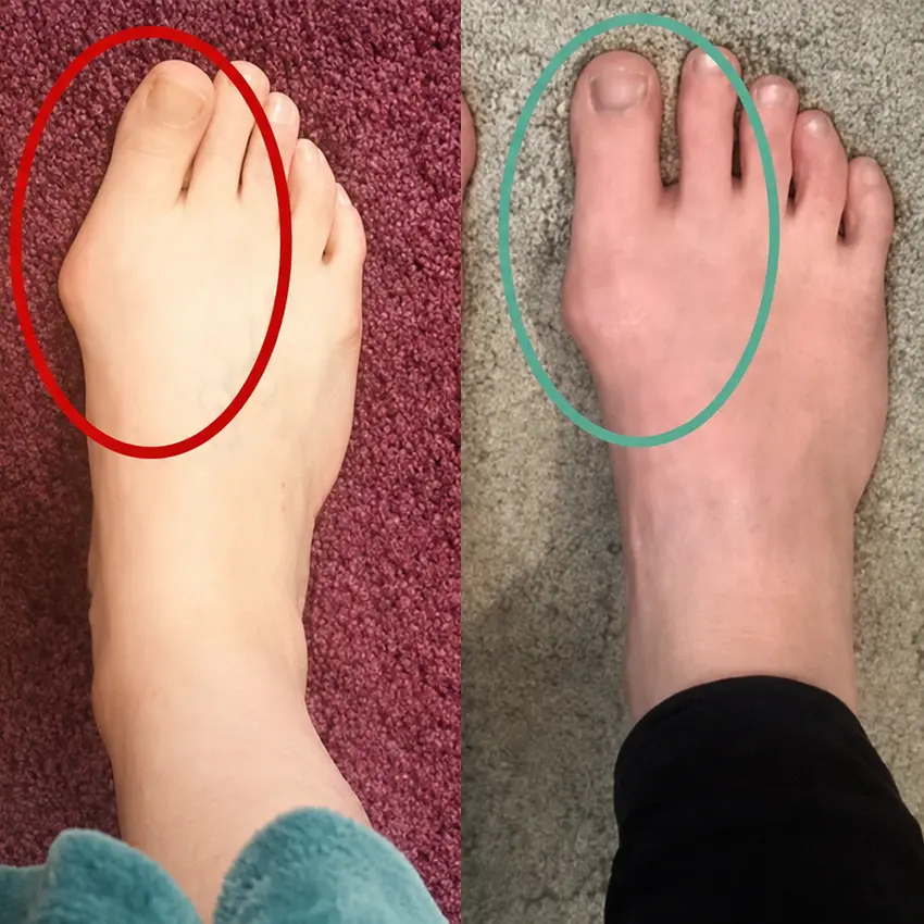 FootAlign EMS Pro —— Advanced EMS Foot Support System - Image 5