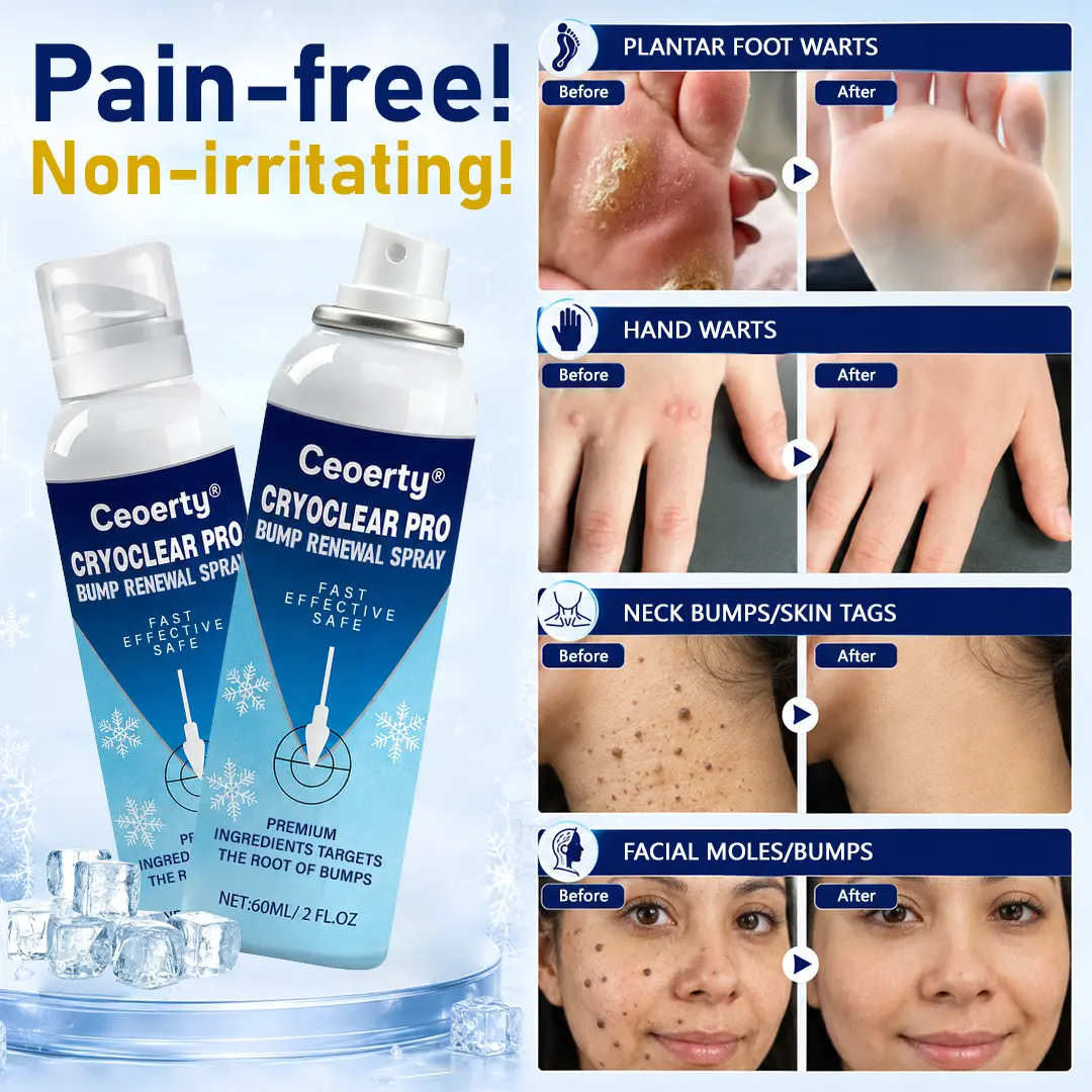 CryoClear Pro Bump Renewal Spray - Image 3