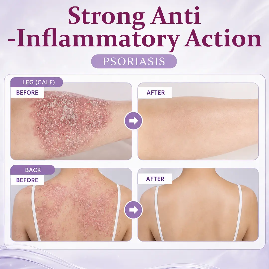 DermaBloom Skin Recovery Cream - Image 4