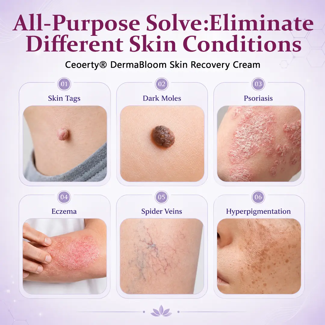 DermaBloom Skin Recovery Cream - Image 5