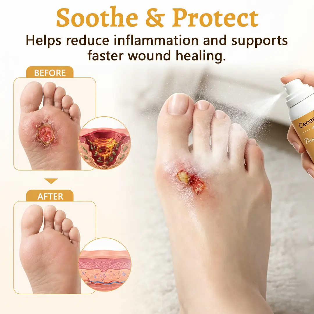 DermaVeil Foot Defense Mist - Image 8