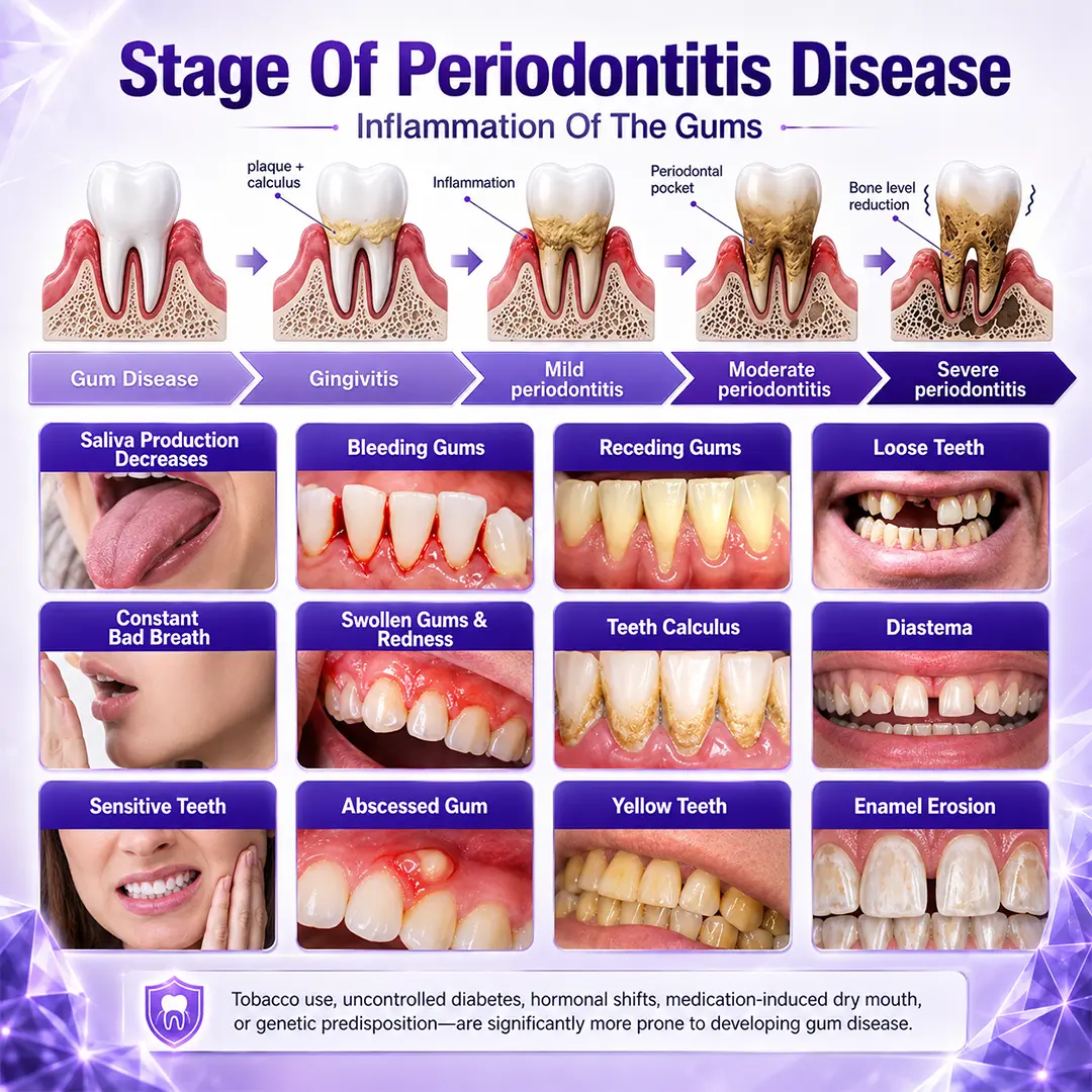 Gingivitis Periodontal Treatment Toothpaste - Image 2