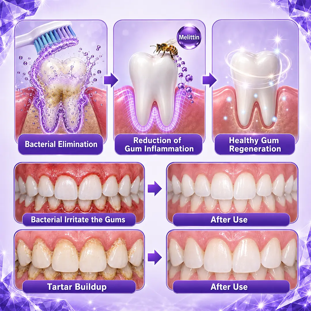 Gingivitis Periodontal Treatment Toothpaste - Image 4