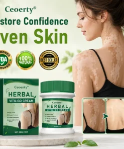 Herbal Vitiligo Cream