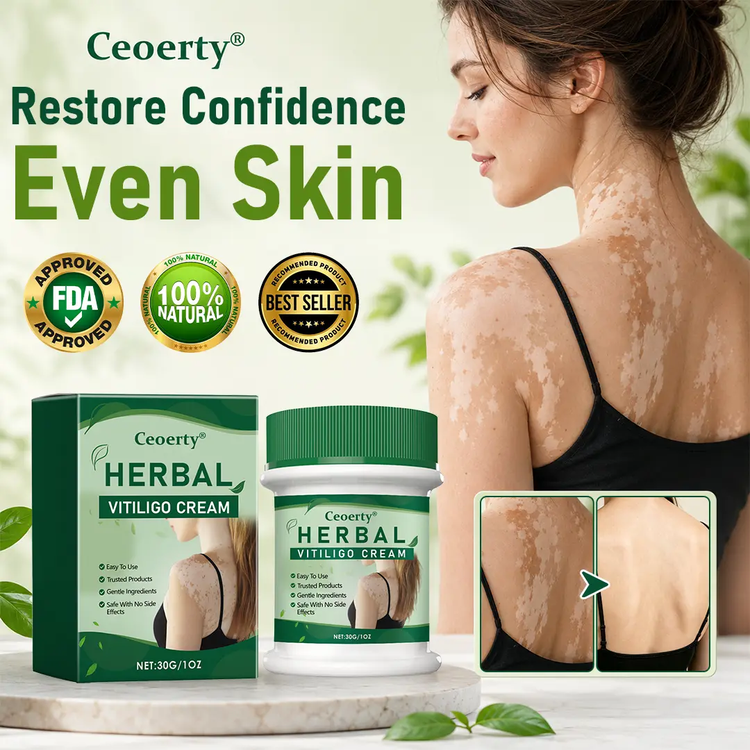 Herbal Vitiligo Cream