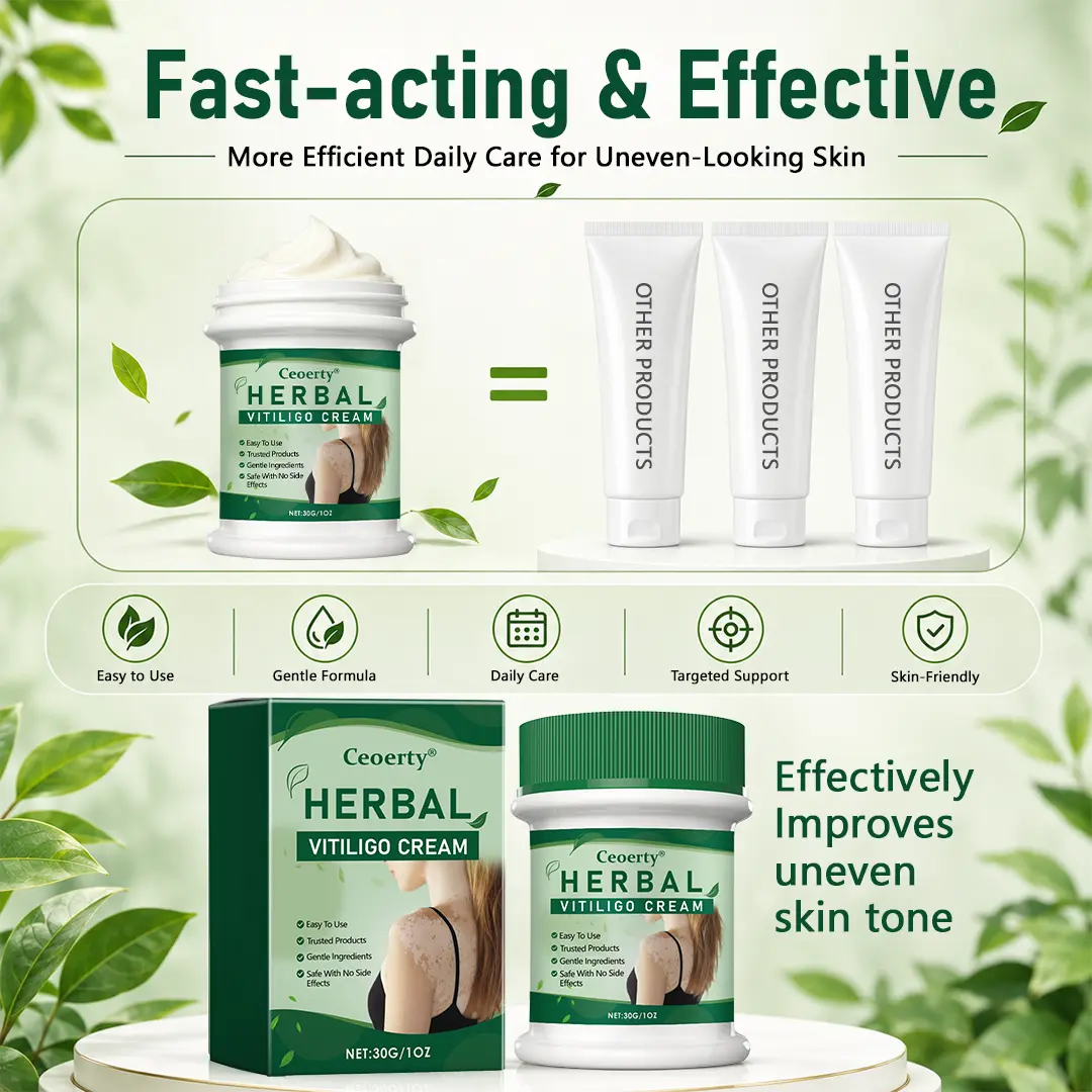 Herbal Vitiligo Cream - Image 3