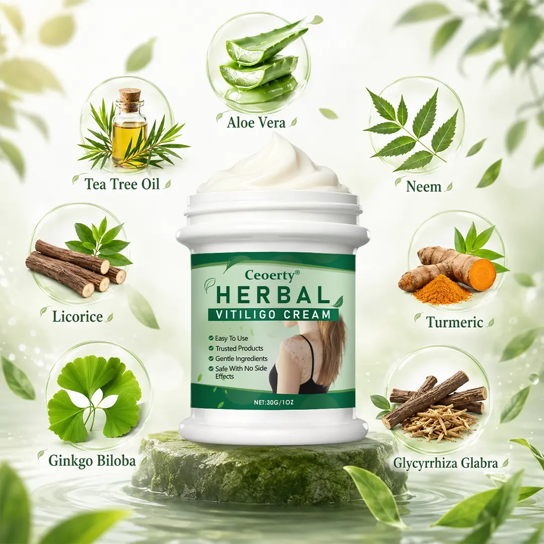Herbal Vitiligo Cream - Image 8