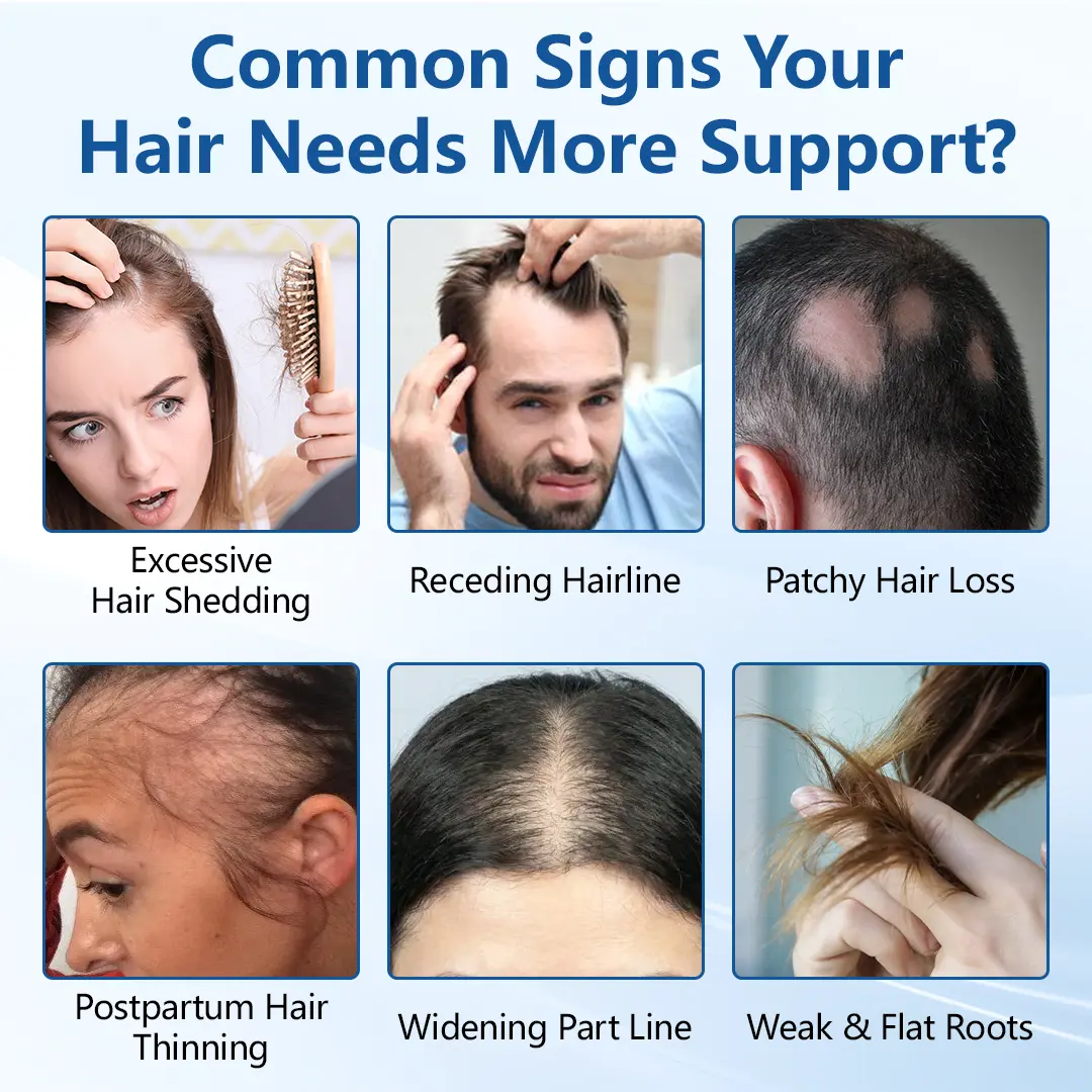 RootVive Hair Growth Serum Roll-On - Image 2