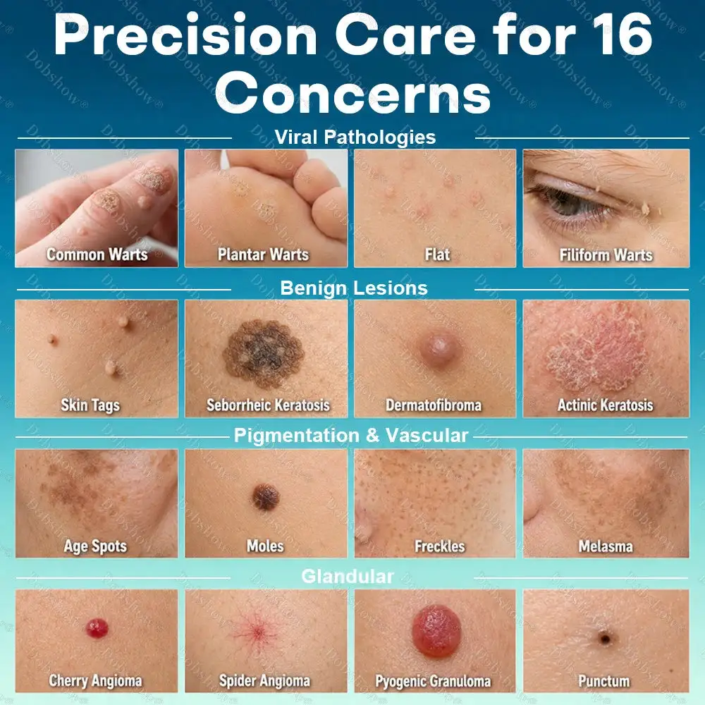 7-Day Blemish Remover Pain-Free & Scar-Free Advanced Roller Pen for Skin Tags and Spots - Image 9