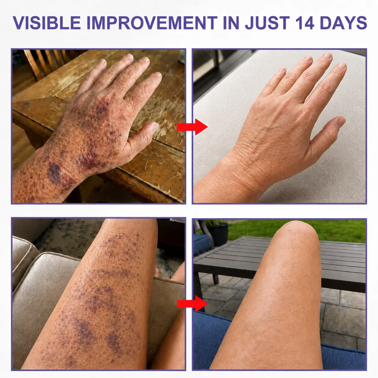 Dark Spot & Bruise Recovery Cream - Image 2