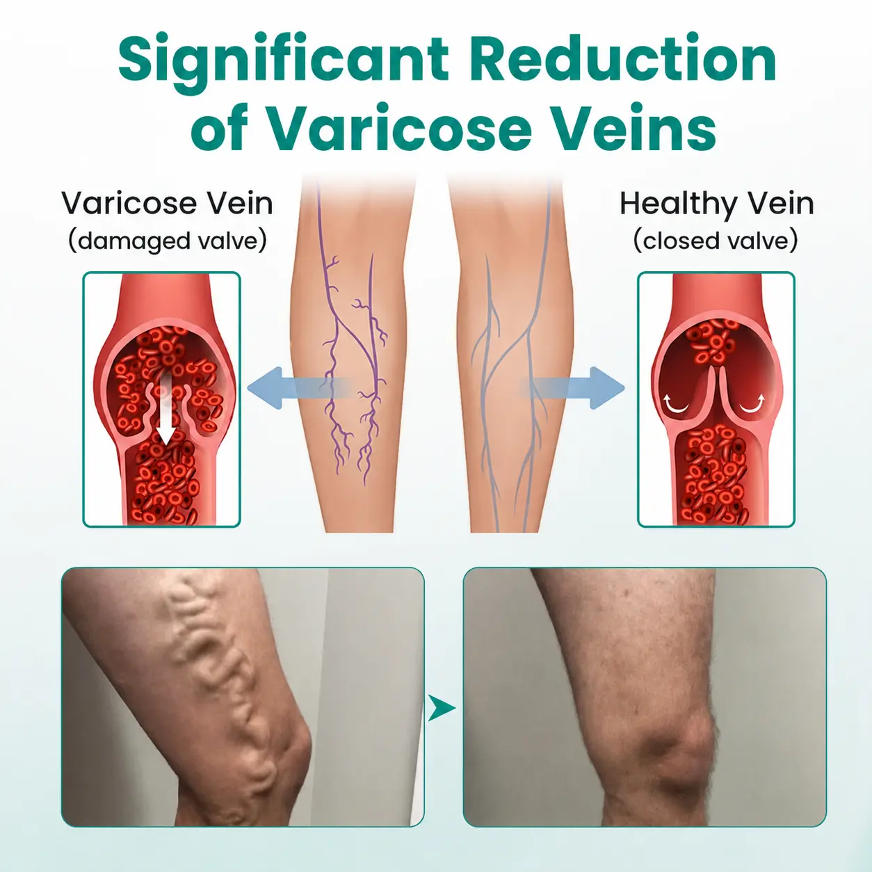 LegRenew Varicose Vein Patch - Image 5