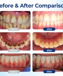 LIMETOW® BeeTakt Oral Repair Solution