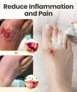 LIMETOW® GlucaVeil 24H Foot Barrier Spray
