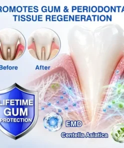 LIMETOW® GumRevive Periodontal Repair Gel
