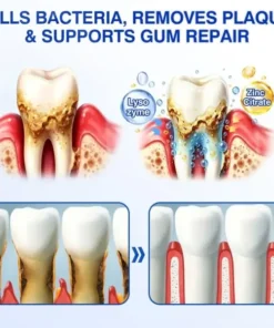 LIMETOW® GumRevive Periodontal Repair Gel