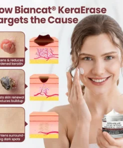 LIMETOW® KeraErase Dual-Action Renewal Cream