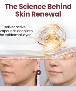 LIMETOW® KeraErase Dual-Action Renewal Cream