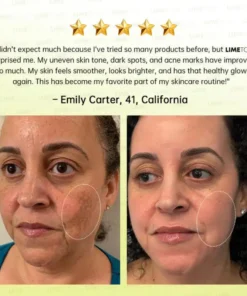 LIMETOW® Multi-Peptide Retinol Shot Wrinkle-Lift Cream