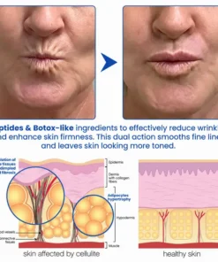 LIMETOW® PDRN Anti-Wrinkle Shot – Lift & Firming Cream