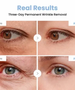 LIMETOW® PDRN Anti-Wrinkle Shot – Lift & Firming Cream
